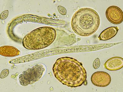 Helminths under microscope
