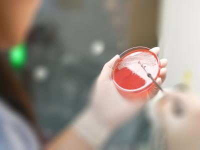 Blood culture