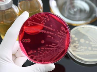 Salmonella in petri dish