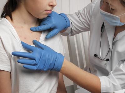 measles check 
