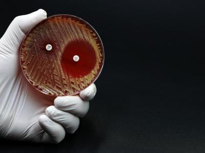 Drug-resistant bacteria in petri dish