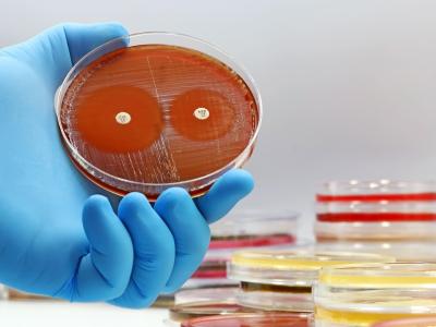 Petri dish with bacterial culture