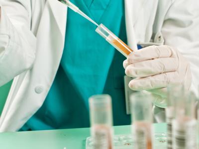 Urine testing