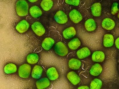 mpox virus green