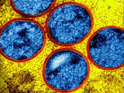 research report on covid 19 for students mpox gold blue