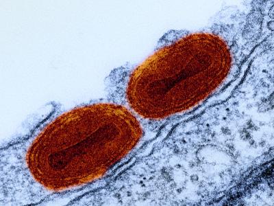 mpox micrograph
