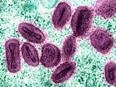 mpox