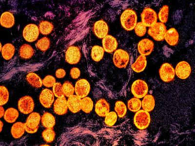 mpox virus particles