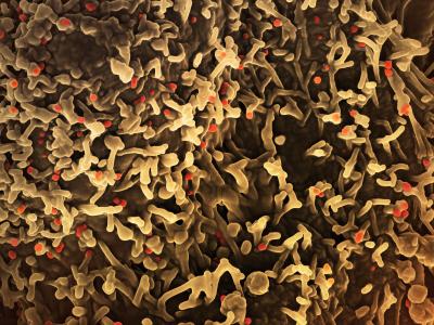 mpox virus 