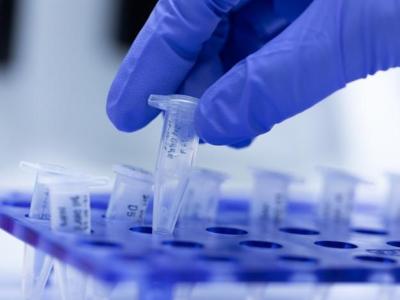 PCR test