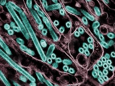 research report on covid 19 for students H5N1 particles