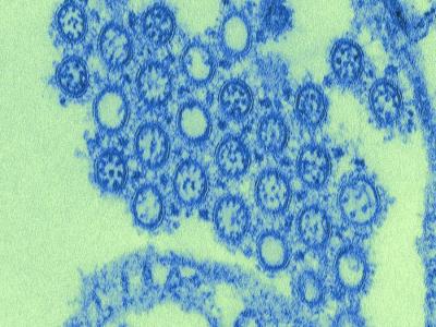 Electromicrograph of pH1N1 influenza virus