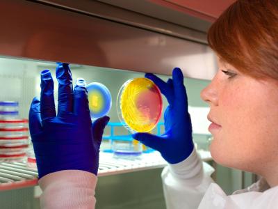 Plates inoculated with methicillin-resistant Staphylococcus aureus (MRSA) bacteria.