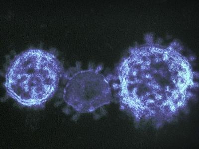Three SARS-CoV-2 viruses