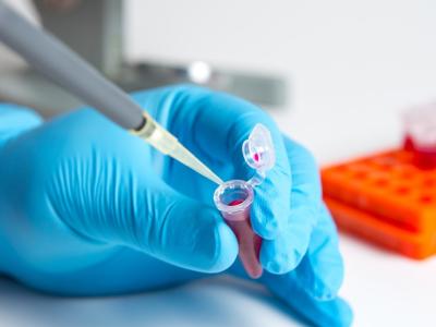 Analyzing a blood sample in a lab