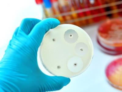 Antimicrobial susceptibility test petri dish