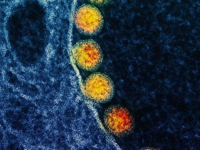 Arc of SARS-CoV-2 viruses