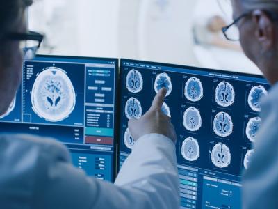 Doctors assessing brain scans