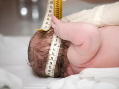 Baby head circumference