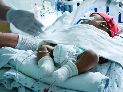 Baby in neonatal intensive care unit NICU