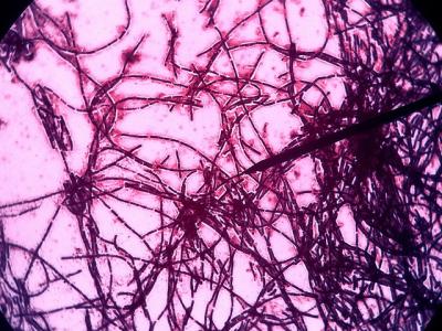 Bacillus subtillis