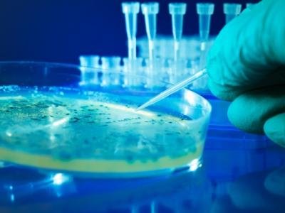 Bacteria culture in petri dish