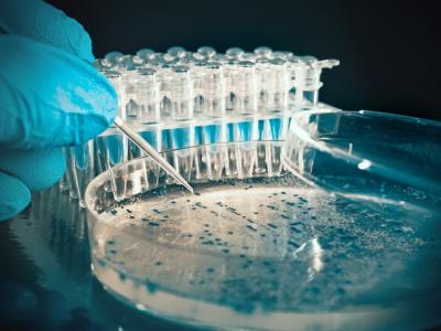 Bacterial colonies