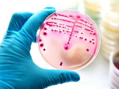 Bacterial culture in petri dish