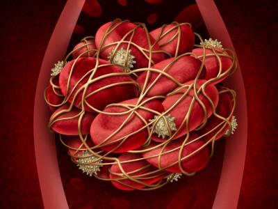 Blood cloot illustration