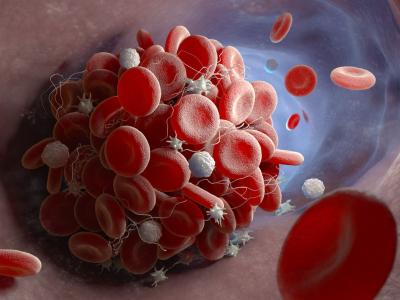 Blood clot illustration