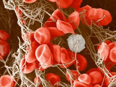 Platelets forming a blood clot