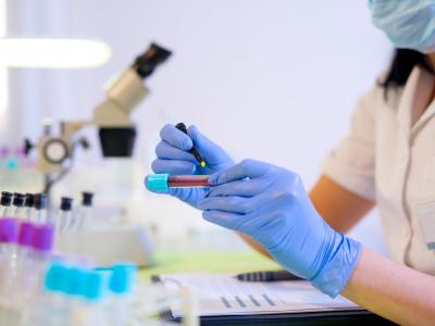 Blood sample in lab