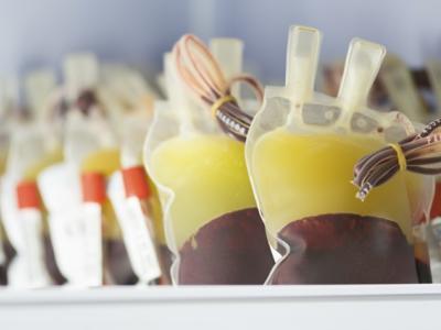 Blood pint photo