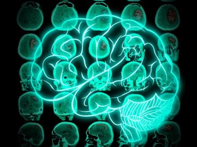 Brain superimposed on CT scans