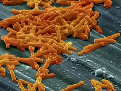 Clostridium difficile