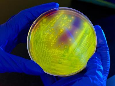 Clostridium difficile in petri dish