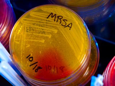 MRSA plates