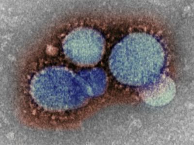 Electron micrograph of MERS-CoV