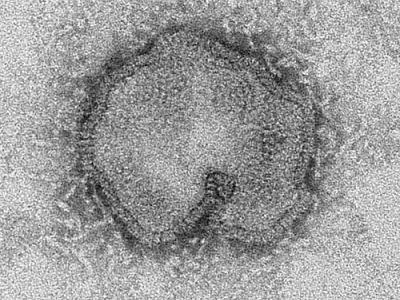 h7n9 electron microscope image