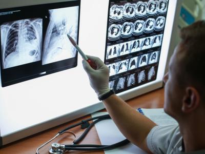 Examining chest x-rays and CT scans