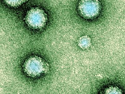 Chikungunya virus micrograph