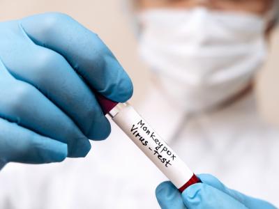 Specimen tube for monkeypox test