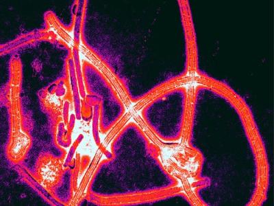 Ebola virus