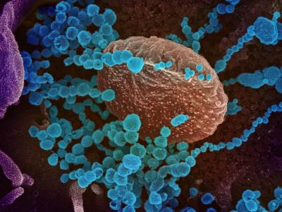 COVID-19 viruses