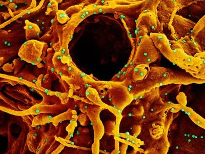 Colorized microscope image of SARS-CoV-2