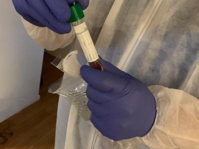 COVID-19 testing vial