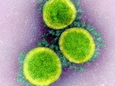 COVID-19 viruses