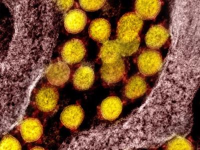 COVID-19 viruses