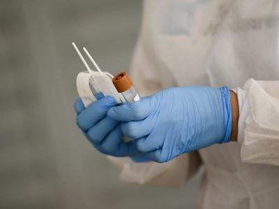 COVID molecular test