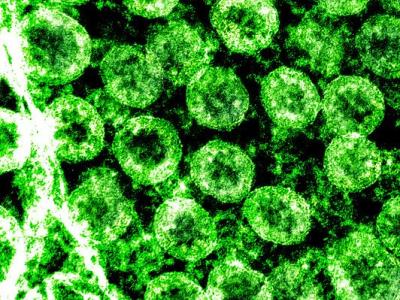 COVID-19 virus SARS-CoV-2